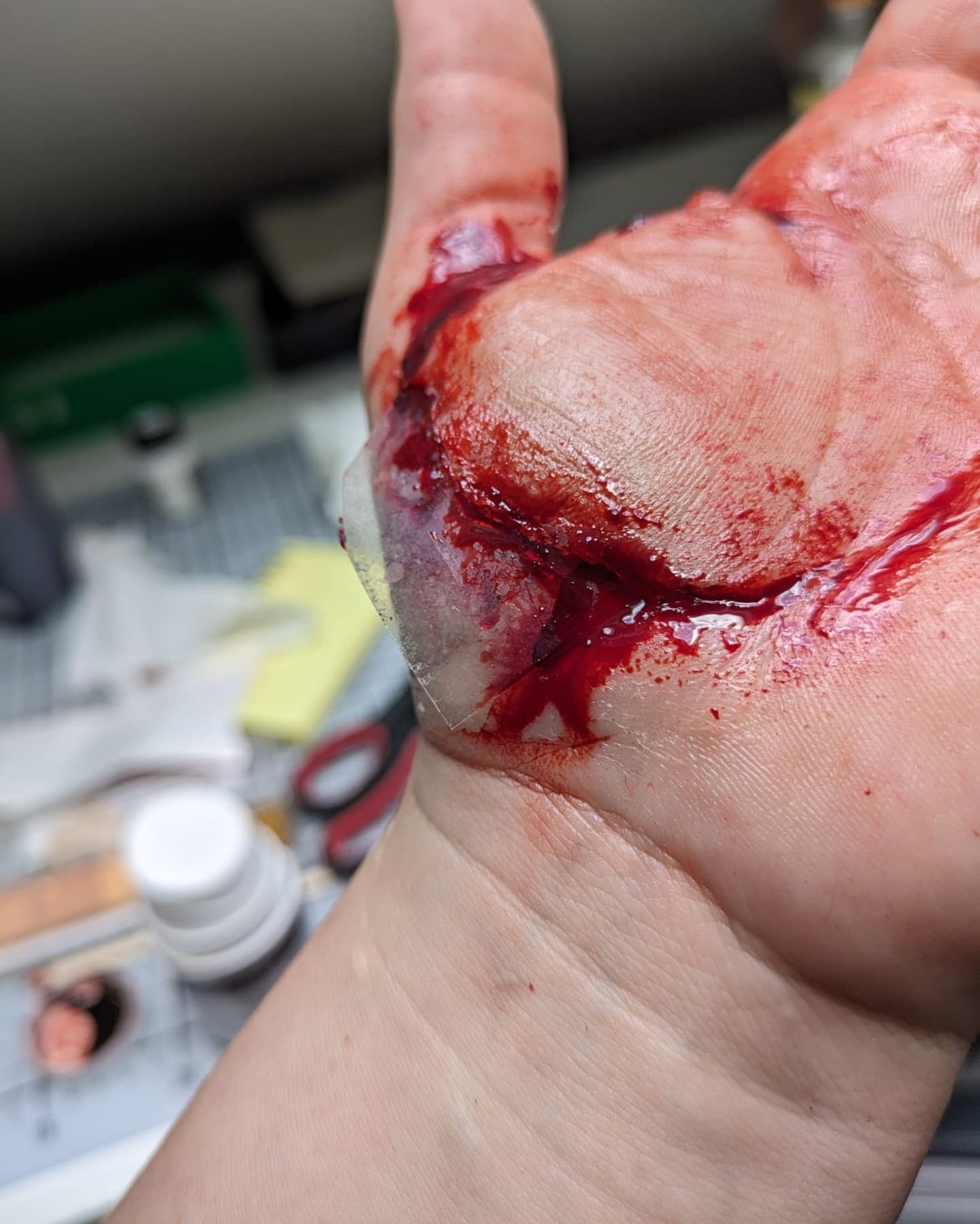 Schnittverletzung · Hand